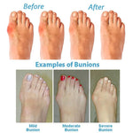 Women's Orthopedic Sandals with Wide Toe Box and Adjustable Straps